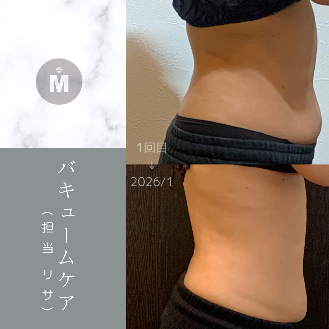 ボディトリートメント